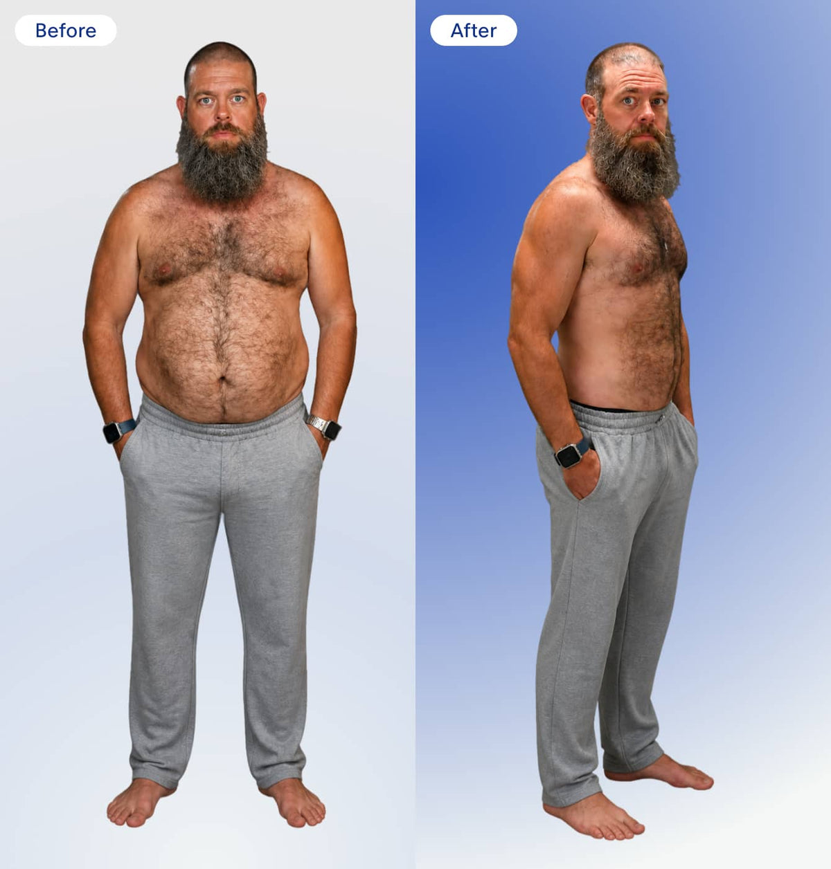 Before and after